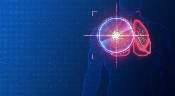 Precision Medicine Unveiled: Nanoparticles in Targeted Drug Delivery Systems